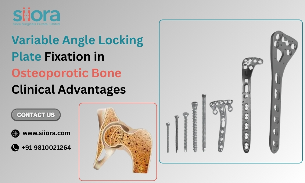 Variable Angle Locking Plate Fixation in Osteoporotic Bone: Clinical&nbsp;Advantages