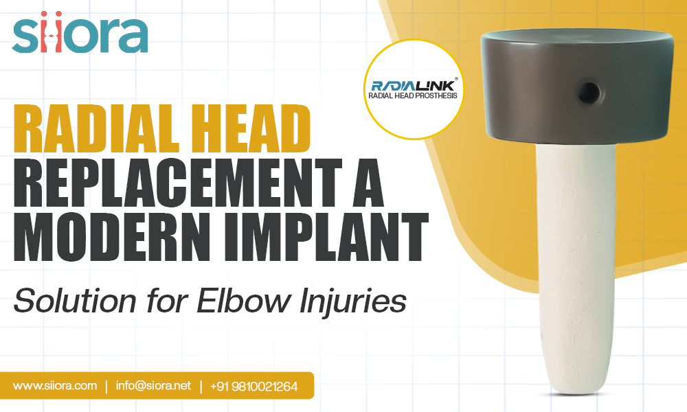 Radial Head Replacement: A Modern Implant Solution for Elbow&nbsp;Injuries